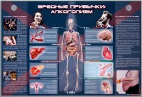 Электрифицированный стенд "Вредные привычки: алкоголизм" - fgospostavki.ru - Балашиха