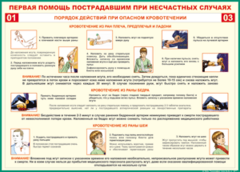Таблица "Порядок действий при опасном кровотечении" (100х140 сантиметров, винил) - fgospostavki.ru - Балашиха