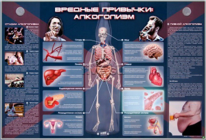 Электрифицированный стенд "Вредные привычки: алкоголизм" - fgospostavki.ru - Балашиха